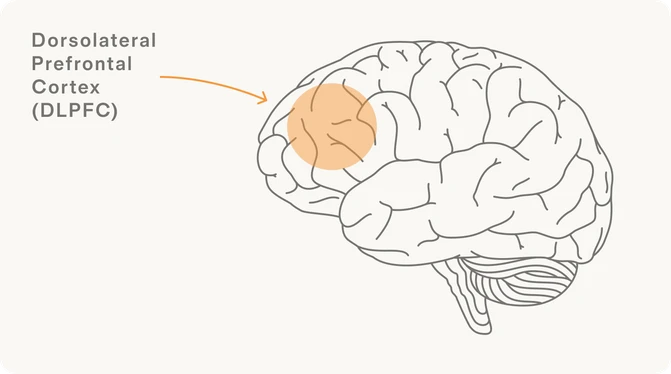 Brain diagram highlighting the Dorsolateral Prefrontal Cortex (DLPFC)