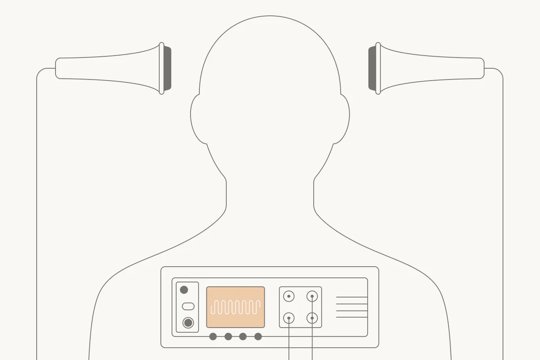 ECT illustration