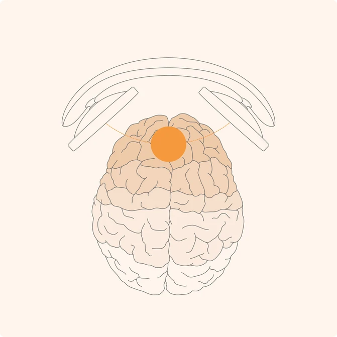 brain stimulation image