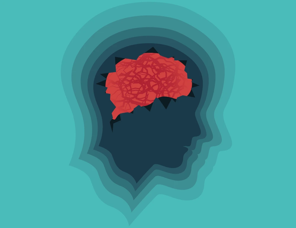 bipolar illustration